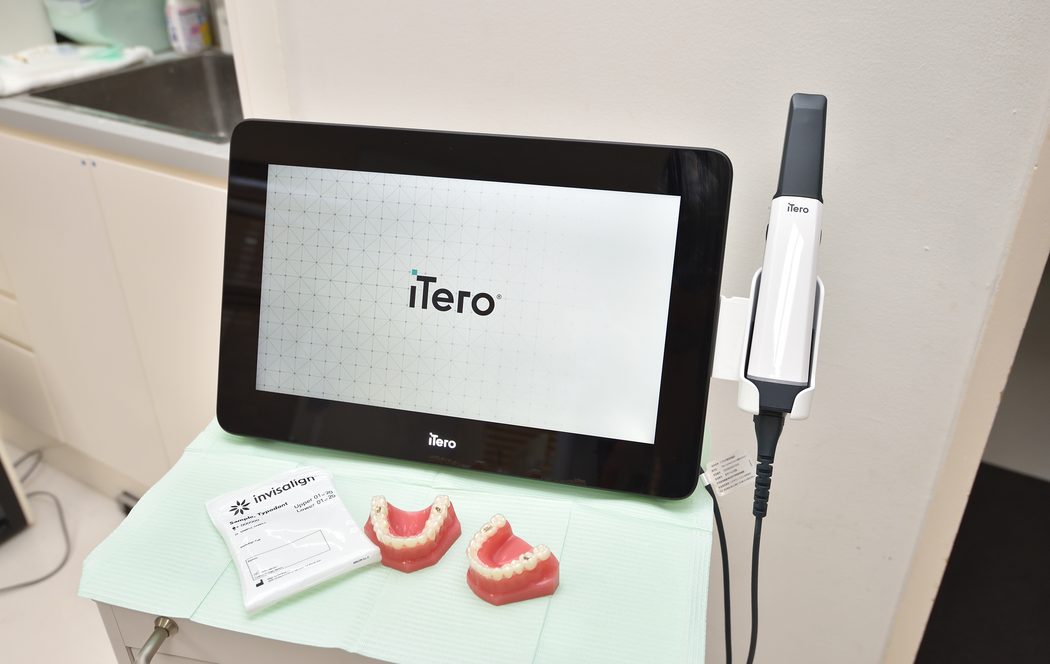 マウスピース型矯正に使う口腔内スキャナー