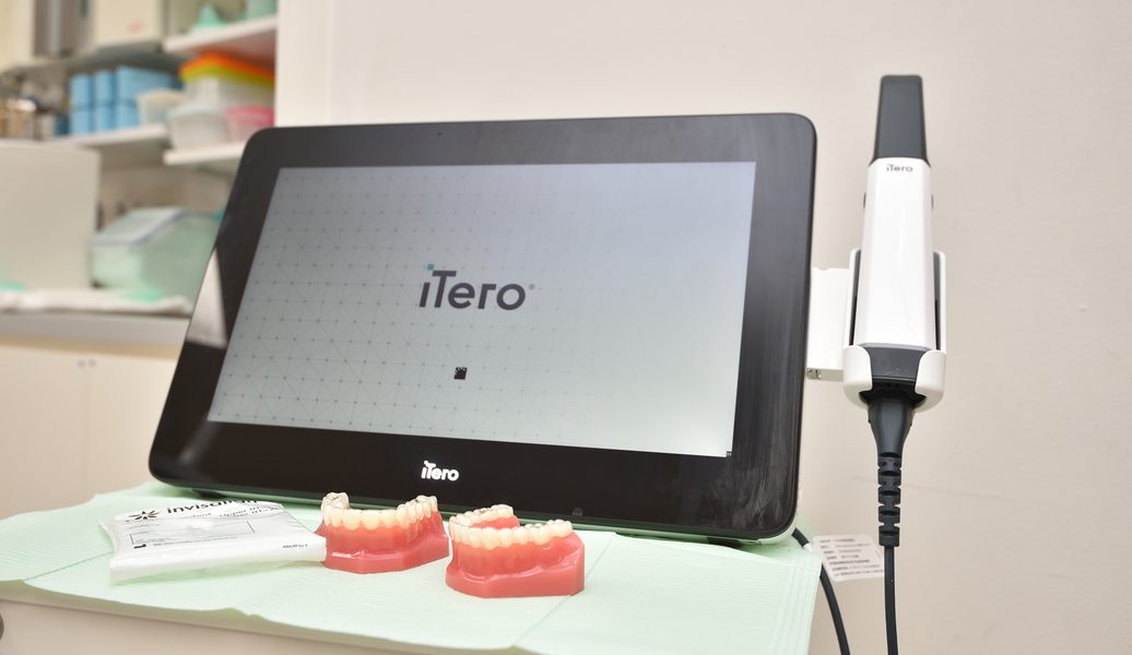 マウスピース型矯正に使う口腔内スキャナー